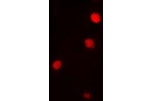 Immunofluorescent analysis of Ataxin 3 staining in Jurkat cells. (Ataxin 3 anticorps)