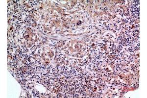 Immunohistochemistry (IHC) analysis of paraffin-embedded Human Lung, antibody was diluted at 1:100. (SCCA1/2 (Internal Region) anticorps)