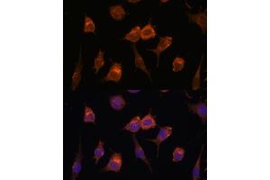 Immunofluorescence analysis of L929 cells using AVIL antibody (ABIN7265508) at dilution of 1:100.