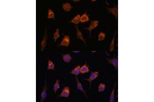 Immunofluorescence analysis of L929 cells using AVIL antibody (ABIN7265508) at dilution of 1:100. (Advillin anticorps  (AA 470-819))