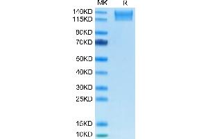 Mouse SEZ6L2 on Tris-Bis PAGE under reduced condition.
