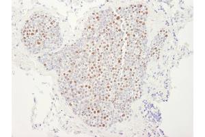 anti-Minichromosome Maintenance Deficient 4 (MCM4) (AA 750-800) antibody