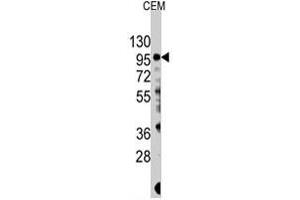 Western blot analysis of PIK3CG polyclonal antibody  in CEM cell lysate (35 ug/lane). (PIK3 gamma anticorps  (Ser1100))
