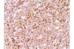 Formalin-fixed, paraffin-embedded human Tonsil stained with CD79a Rabbit Recombinant Monoclonal Antibody (IGA/1688R). (Recombinant CD79a anticorps  (AA 202-216))