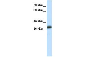 WB Suggested Anti-SAP30BP Antibody Titration:  0. (SAP30BP anticorps  (C-Term))