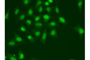 Immunofluorescence analysis of A549 cells using POLD1 antibody. (POLD1 anticorps)