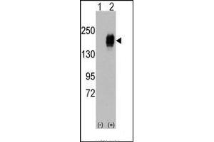 Western blot analysis of EGFR (arrow) using rabbit polyclonal EGFR Antibody. (EGFR anticorps  (Tyr987))
