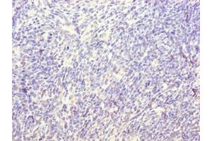 Immunohistochemistry of paraffin-embedded human thymus tissue using ABIN7171361 at dilution of 1:100 (TRIM anticorps  (AA 29-186))