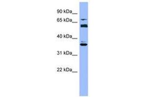 Image no. 1 for anti-Cytochrome P450, Family 2, Subfamily B, Polypeptide 6 (CYP2B6) (AA 215-264) antibody (ABIN6749723) (CYP2B6 anticorps  (AA 215-264))