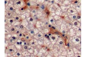 Detection of Ki-67 in Human Liver Tissue using Polyclonal Antibody to Ki-67 Protein (Ki-67) (Ki-67 anticorps  (AA 2815-2928))