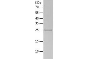 Western Blotting (WB) image for Mediator Complex Subunit 20 (MED20) (AA 1-212) protein (His-IF2DI Tag) (ABIN7123871)