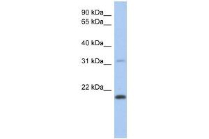 WB Suggested Anti-CLECL1 Antibody Titration: 0. (CLECL1 anticorps  (Middle Region))