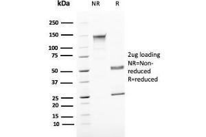 SDS-PAGE Analyis Purified Uroplakin 1B Mouse Monoclonal Antibody (UPK1B/3081). (Uroplakin 1B anticorps  (AA 109-229))