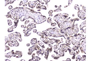 IHC analysis of TCP1 alpha using anti-TCP1 alpha antibody . (TCP1 alpha/CCTA anticorps  (C-Term))