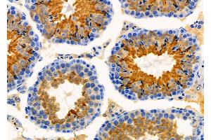 ABIN6260461 and ABIN6276363 at 1/100 staining Mouse testis tissue by IHC-P. (CARD8 anticorps  (Internal Region))