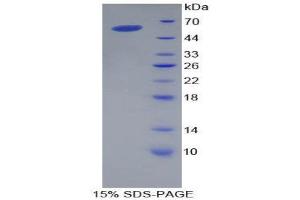 SDS-PAGE (SDS) image for Apolipoprotein A-I (APOA1) (AA 25-265) protein (His tag,GST tag) (ABIN1879875)