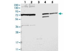 Western blot analysis of Lane 1: RT-4, Lane 2: U-251 MG, Lane 3: Human Plasma, Lane 4: Liver, Lane 5: Tonsil with FAM161B polyclonal antibody  at 1:250-1:500 dilution. (FAM161B anticorps)