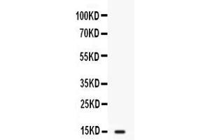 Western blot analysis of FABP2/I-FABP expression in SW620 whole cell lysates ( Lane 1).