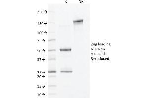 SDS-PAGE Analysis Purified ALDH1A1 Mouse Monoclonal Antibody (ALDH1A1/1381).