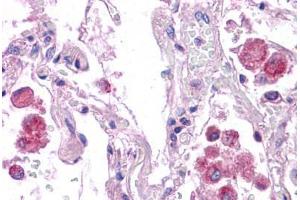 Human Lung: Formalin-Fixed, Paraffin-Embedded (FFPE)