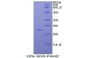 SDS-PAGE analysis of Human RAD54 Like Protein 2 Protein. (ARIP4 Protéine)