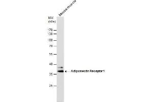 WB Image Adiponectin Receptor 1 antibody detects Adiponectin Receptor 1 protein by western blot analysis.