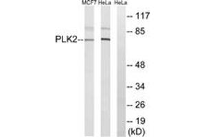 Western blot analysis of extracts from HeLa/MCF-7 cells, using PLK2 Antibody.