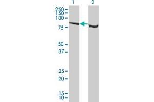 Western Blot analysis of SP1 expression in transfected 293T cell line by SP1 monoclonal antibody (M05), clone 4B11.