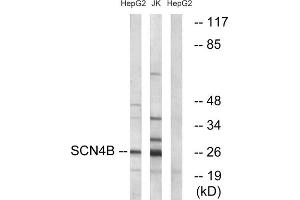 Western blot analysis of extracts from HepG2 cells and Jurkat cells, using SCN4B antibody. (SCN4B anticorps  (Internal Region))