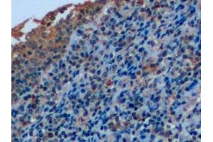 Detection of CD7 in Human Tonsil Tissue using Polyclonal Antibody to Cluster Of Differentiation 7 (CD7)