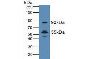 Figure. (MST1R anticorps  (AA 1092-1316))