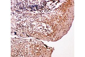 Anti-Caspase-14 antibody, IHC(P) IHC(P): Human Tonsil Tissue (CASP14 anticorps  (C-Term))