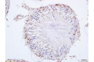 Formalin-fixed and paraffin embedded rat testis labeled with Anti-SEPT14 Polyclonal Antibody, Unconjugated  at 1:200 followed by conjugation to the secondary antibody and DAB staining (Septin 14 anticorps  (AA 351-432))