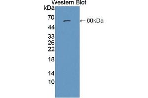 Detection of Recombinant PSAP, Human using Polyclonal Antibody to Prosaposin (PSAP)