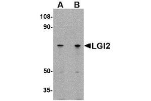 Image no. 1 for anti-Leucine-Rich Repeat LGI Family, Member 2 (LGI2) (N-Term) antibody (ABIN1494389) (LGI2 anticorps  (N-Term))