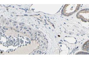 ABIN6269106 at 1/100 staining Human prostate tissue by IHC-P. (EIF4E anticorps  (C-Term))