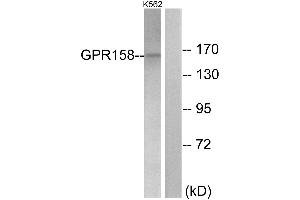 Immunohistochemistry analysis of paraffin-embedded human brain tissue using GPR158 antibody. (GPR158 anticorps  (Internal Region))
