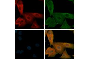 ABIN6256279 and ABIN6267329 staining  cells(H2O2 treatment) by IF/ICC. (beta 2 Adrenergic Receptor anticorps  (pSer346))
