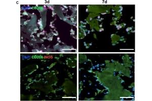 Switching off of inflammation. (IL-10 anticorps  (AA 101-178))