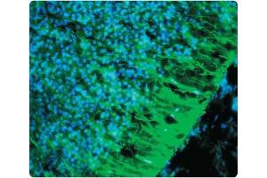 A tissue section through an e13 Mouse brain showing Nestin (green staining) in neural stem cells of the ventricular zone of the CNS.