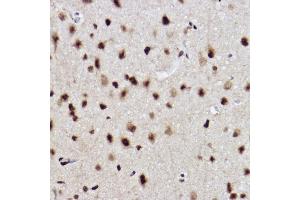 Immunohistochemistry of paraffin-embedded rat brain using UBE2B Rabbit mAb (ABIN7271173) at dilution of 1:100 (40x lens).