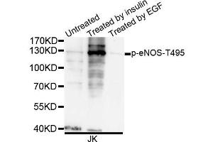 Western blot analysis of extracts of JK cells, using Phospho-eNOS-T495 antibody (ABIN5995598).