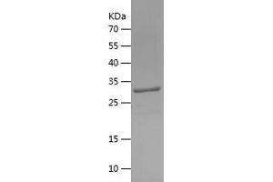Western Blotting (WB) image for Chromosome 14 Open Reading Frame 169 (C14orf169) (AA 169-433) protein (His tag) (ABIN7122379)