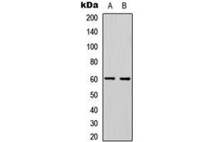 Western blot analysis of PDCD4 (pS457) expression in HeLa (A), Jurkat (B) whole cell lysates. (PDCD4 anticorps  (C-Term, pSer457))