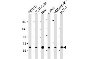 All lanes : Anti-RNF31 Antibody (C-term) at 1:2000 dilution Lane 1: 293T/17 whole cell lysate Lane 2: CCRF-CEM whole cell lysate Lane 3: Hela whole cell lysate Lane 4: Jurkat whole cell lysate Lane 5: MDA-MB-453 whole cell lysate Lane 6: MCF-7 whole cell lysate Lysates/proteins at 20 μg per lane. (RNF31 anticorps  (C-Term))
