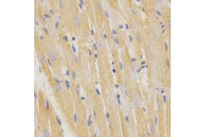Immunohistochemistry (IHC) image for anti-Surfactant Protein C (SFTPC) (AA 1-197) antibody (ABIN3015598)
