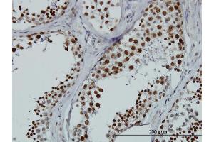 Immunoperoxidase of monoclonal antibody to HNRNPG-T on formalin-fixed paraffin-embedded human testis.