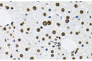 Immunohistochemistry of paraffin-embedded Mouse liver using MCL1 Polyclonal Antibody at dilution of 1:100 (40x lens). (MCL-1 anticorps)