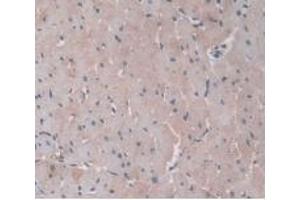 DAB staining on IHC-P; Samples: Rat Heart Tissue. (ORM1 anticorps  (AA 19-186))