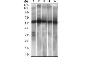 Western blot analysis using ALDH2 mouse mAb against HepG2 (1), A549 (2) cell lysate, and Rat liver (3), Mouse liver (4), Mouse brain (5) tissue lysate.